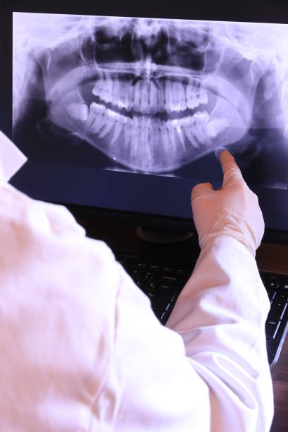 Best Emergency Root Canal Treatment in Sudley, VA